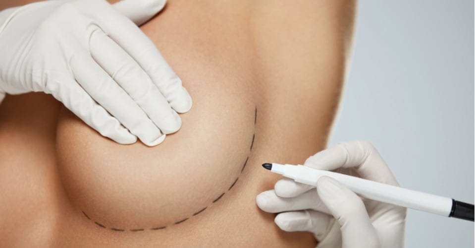 Breast Augmentation