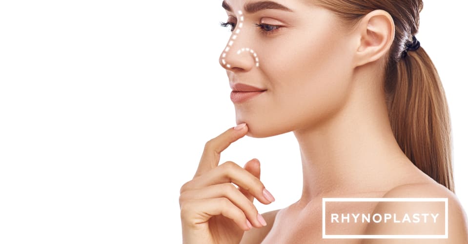 Rhinoplasty