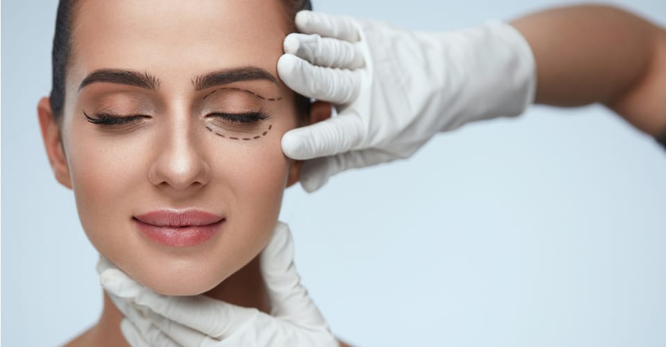 eyelid surgery