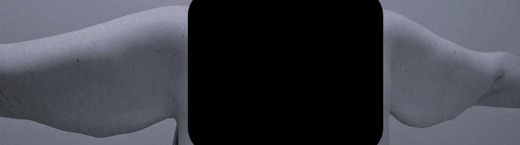 back view preop back view preop