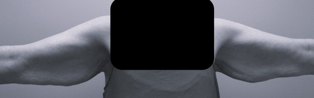 front view preop front view preop